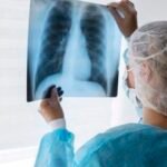 Beda Jenis Rokok, Beda Letak Kanker: Kenali Risiko Setiap Varian Rokok