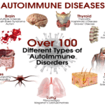 Sistem Kekebalan Tubuh yang Berbalik Melawan Diri Sendiri: Memahami Penyakit Autoimun